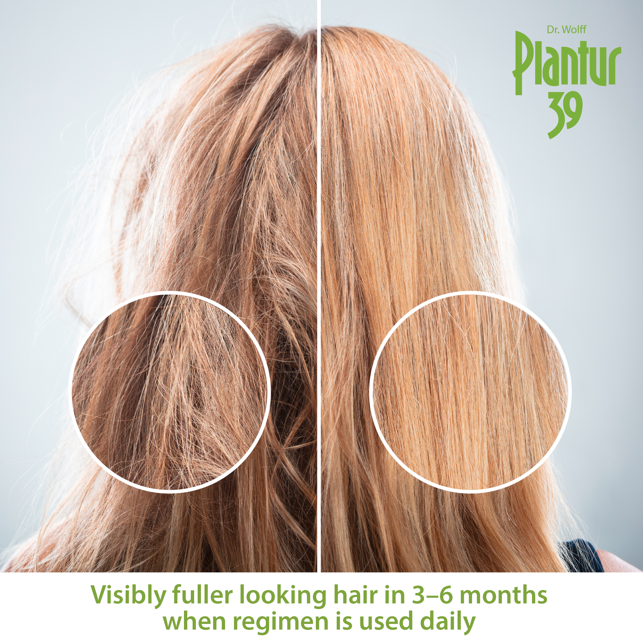 Plantur 39 Phyto-Caffeine Cleanse & Nourish Kit for Fine, Brittle Hair